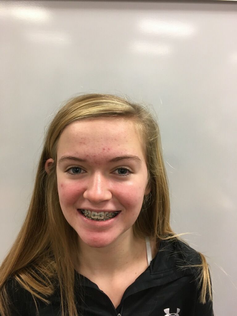 Ally Capouch, Kouts, basketball